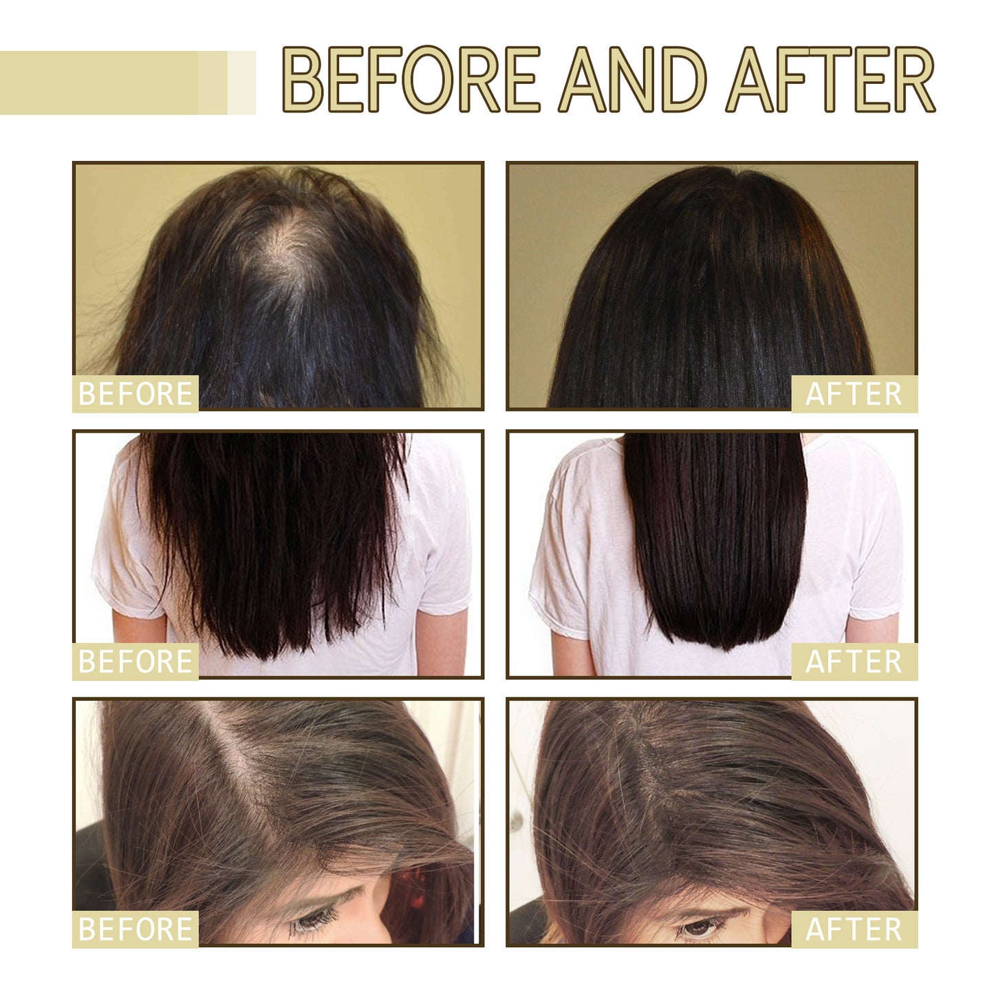 60ml Hair Growth Oil - Reduces Hair Loss, Fights Frizz, Nourishes Scalp, Repairs Damage
