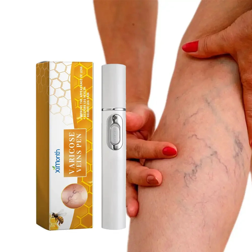 Varicose Veins Pen - Blue Light Therapy Pen Relieves Pain, Improves Circulation
