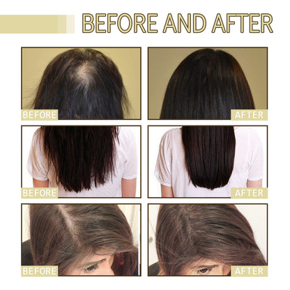 60ml Hair Growth Oil - Reduces Hair Loss, Fights Frizz, Nourishes Scalp, Repairs Damage