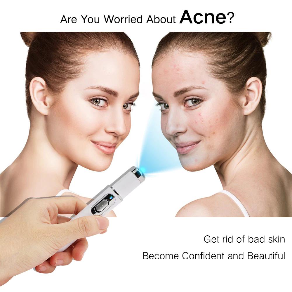 Varicose Veins Pen - Blue Light Therapy Pen Relieves Pain, Improves Circulation