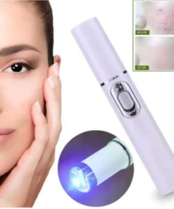 Spider Veins Removal Pen – Blue Light Treatment Laser Pen Soft Acne Scars Wrinkle Removal Visible Clear Light Therapy1