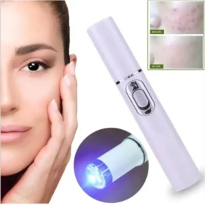 Spider Veins Removal Pen – Blue Light Treatment Laser Pen Soft Acne Scars Wrinkle Removal Visible Clear Light Therapy1