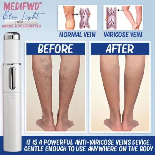 Medifwd-Blue-Light-Therapy-Varicose-Veins-Pen