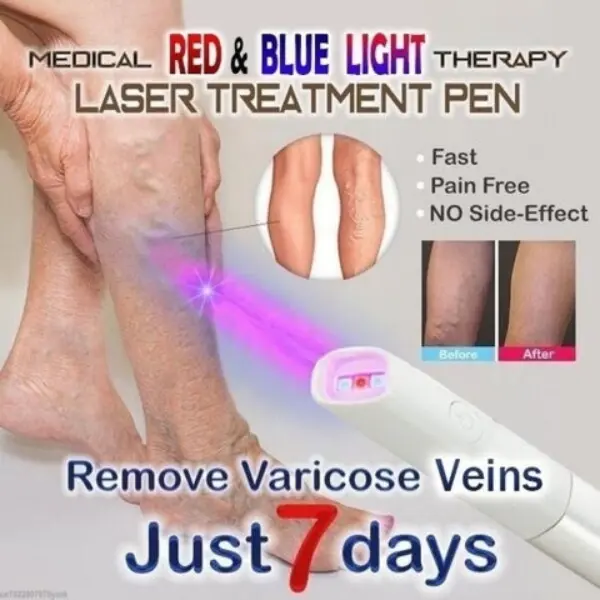 Medifwd-Blue-Light-Therapy-Varicose-Veins-Pen