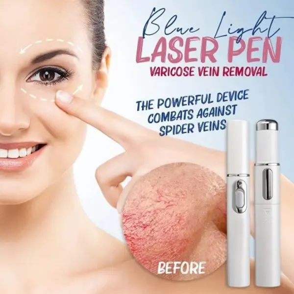 Spider Veins Removal Pen