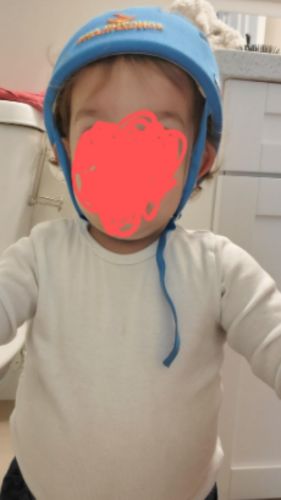 Baby Safety Helmet – Soft & Breathable Cotton Hat for Crawling & Walking (6M–5Y) photo review