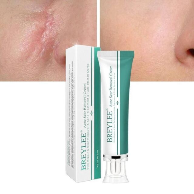Herbal Scar Removal Gel Cream with Niacinamide and Growth Factor (30ml)