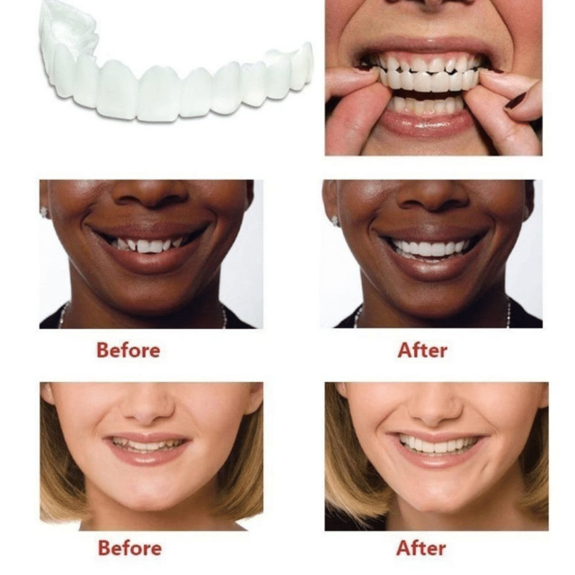 Reusable Silicone Dentures For Upper And Lower Jaws - Image 2