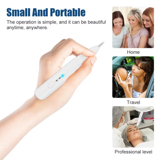 3-Level Plasma Pen for Freckle, Tattoo and Skin Tag Removal - Image 5