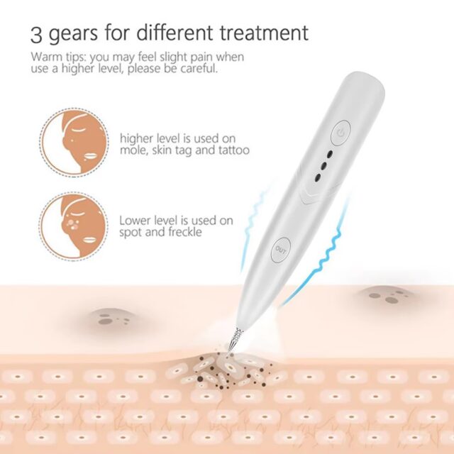 3-Level Plasma Pen for Freckle, Tattoo and Skin Tag Removal - Image 7