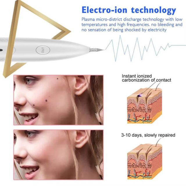 3-Level Plasma Pen for Freckle, Tattoo and Skin Tag Removal - Image 8