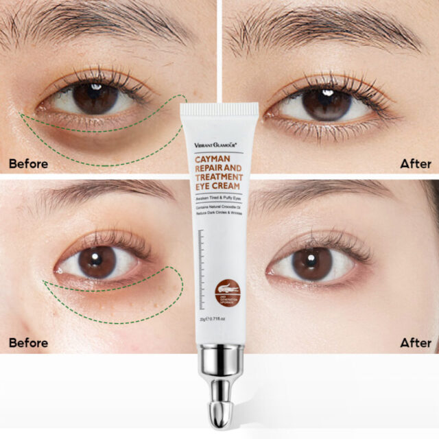 Anti-Aging Eye Cream for Wrinkles, Dark Circles, and Puffiness (20g) - Image 2
