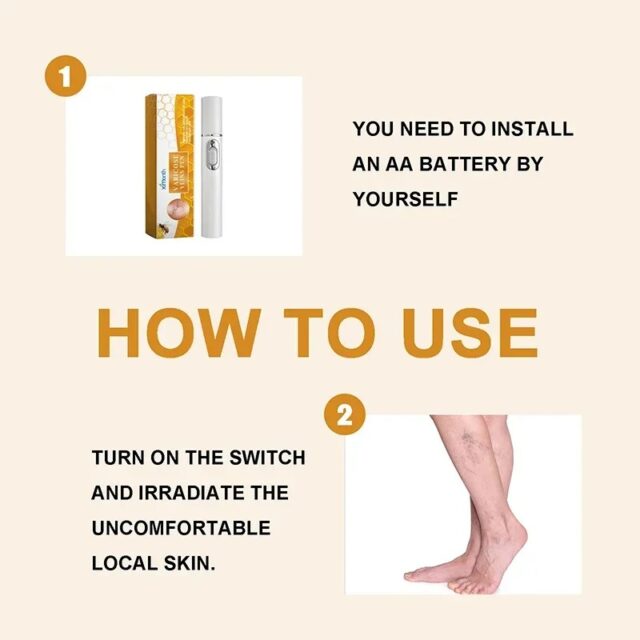 Varicose Veins Pen Relieves Pain & Improves Circulation - Image 10