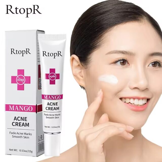 Acne Treatment Cream for Blackheads, Scars, and Oil Control - Image 7