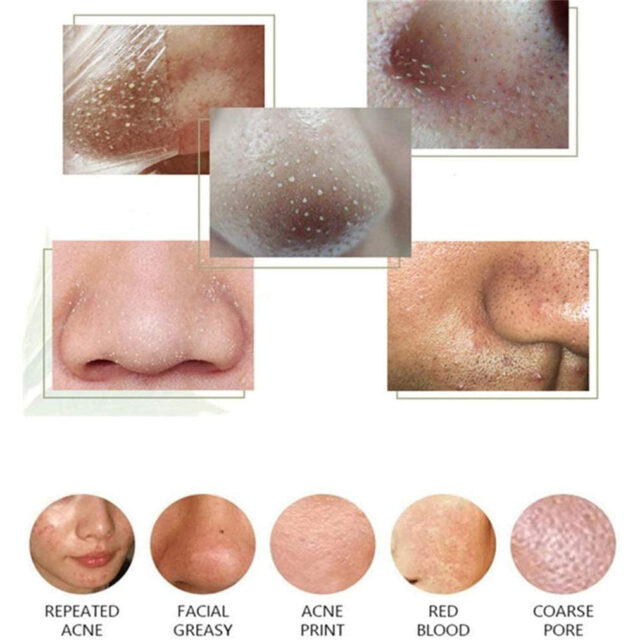 Deep Cleansing Green Tea Blackhead Peel-Off Mask 40ml - Image 5