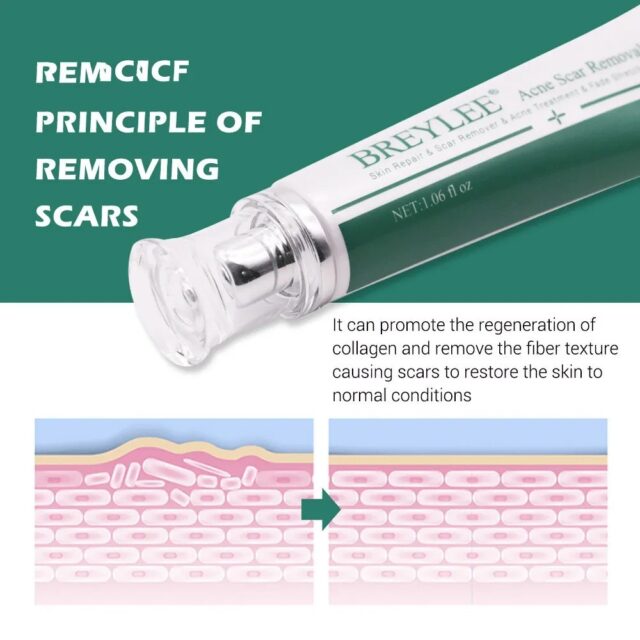 Herbal Scar Removal Gel Cream with Niacinamide and Growth Factor (30ml) - Image 6