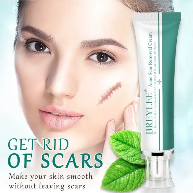 Herbal Scar Removal Gel Cream with Niacinamide and Growth Factor (30ml) - Image 5