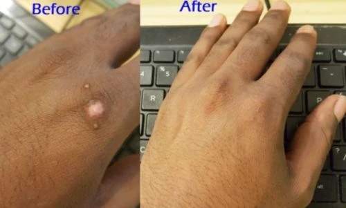 Herbal Scar Removal Gel Cream with Niacinamide and Growth Factor (30ml) photo review