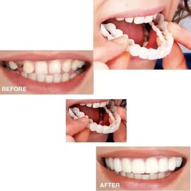 Reusable Silicone Dentures For Upper And Lower Jaws - Image 7