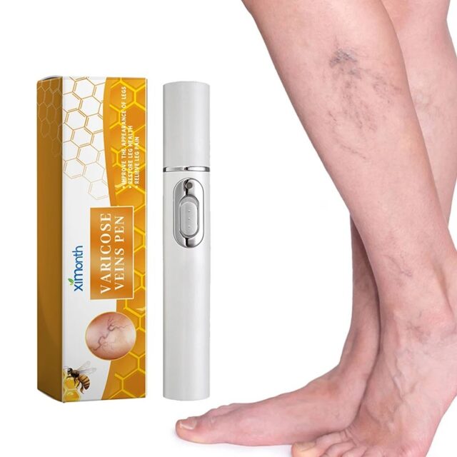 Varicose Veins Pen Relieves Pain & Improves Circulation