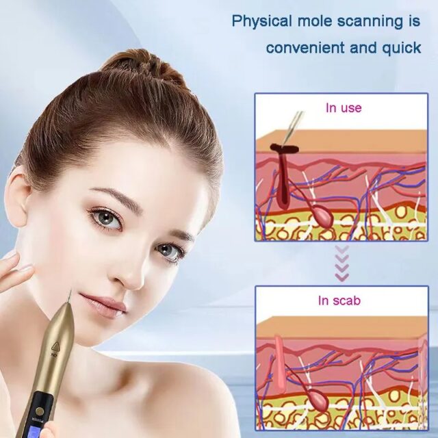 Painless Laser Plasma Skin Remover – Professional Home Use - Image 6