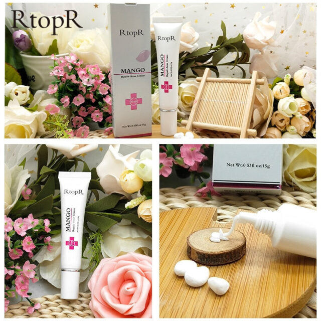 Acne Treatment Cream for Blackheads, Scars, and Oil Control - Image 4