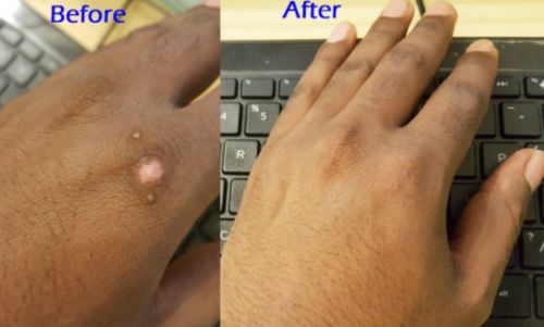 Herbal Scar Removal Gel Cream with Niacinamide and Growth Factor (30ml) photo review