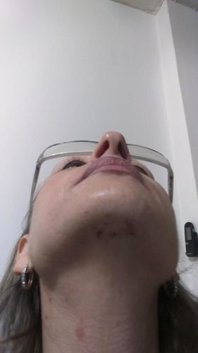 Herbal Scar Removal Gel Cream with Niacinamide and Growth Factor (30ml) photo review