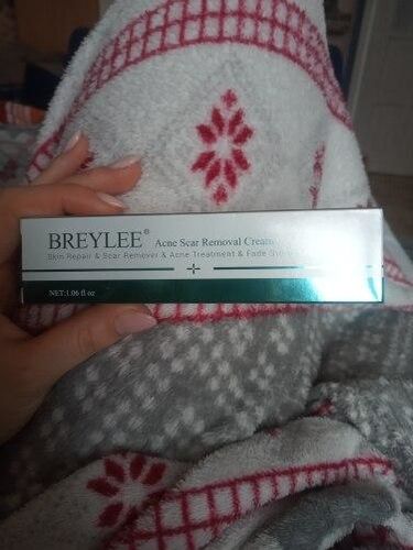 Herbal Scar Removal Gel Cream with Niacinamide and Growth Factor (30ml) photo review