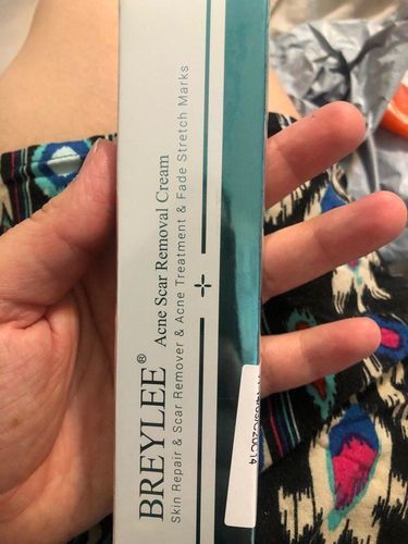 Herbal Scar Removal Gel Cream with Niacinamide and Growth Factor (30ml) photo review