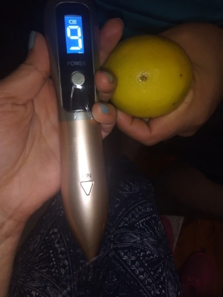 Painless Laser Plasma Skin Remover – Professional Home Use photo review