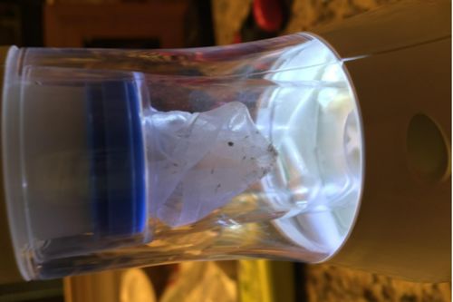 Electric Pet Comb for Dogs & Cats – Effective Lice & Flea Removal photo review