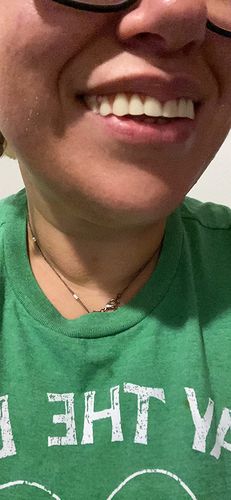 Reusable Silicone Dentures For Upper And Lower Jaws photo review