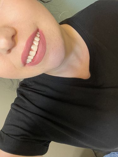 Reusable Silicone Dentures For Upper And Lower Jaws photo review