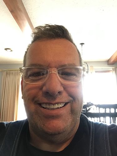 Reusable Silicone Dentures For Upper And Lower Jaws photo review