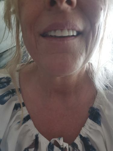 Reusable Silicone Dentures For Upper And Lower Jaws photo review