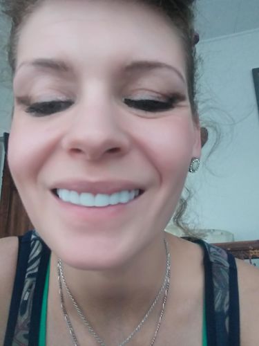 Reusable Silicone Dentures For Upper And Lower Jaws photo review