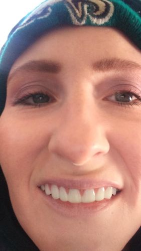 Reusable Silicone Dentures For Upper And Lower Jaws photo review