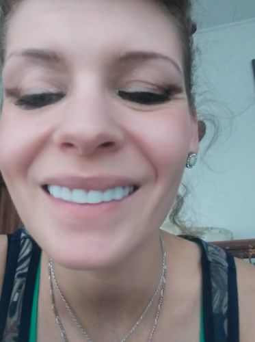Reusable Silicone Dentures For Upper And Lower Jaws photo review