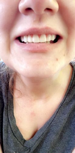 Reusable Silicone Dentures For Upper And Lower Jaws photo review
