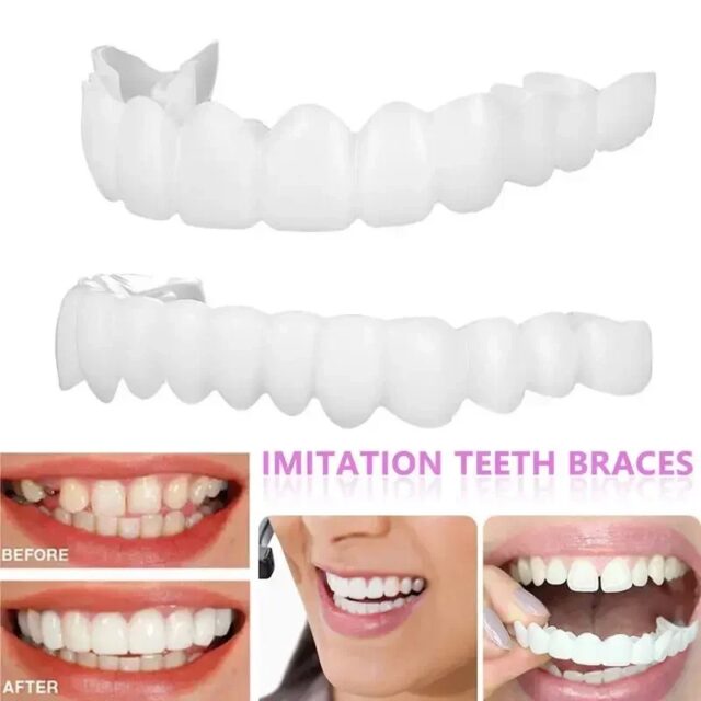 Reusable Silicone Dentures For Upper And Lower Jaws - Image 5