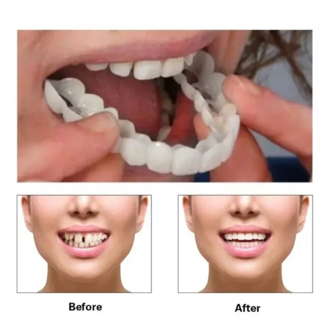 Reusable Silicone Dentures For Upper And Lower Jaws - Image 3