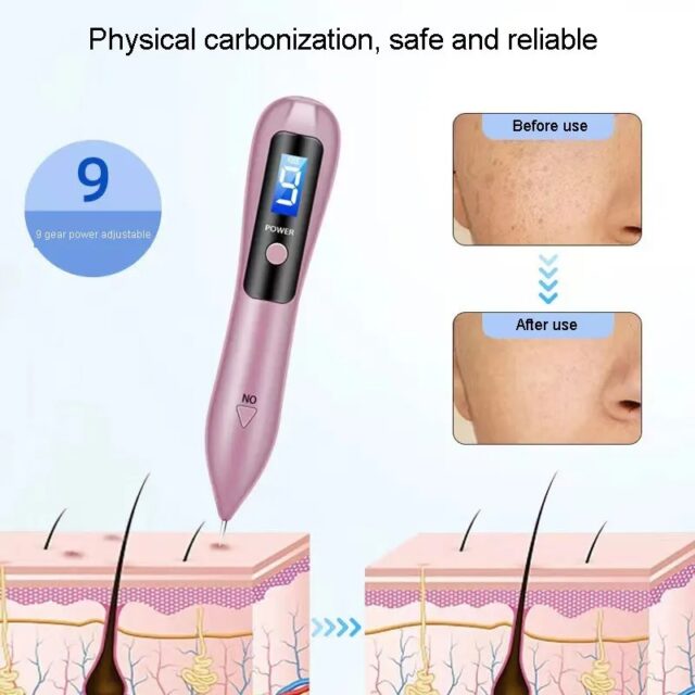 Painless Laser Plasma Skin Remover – Professional Home Use - Image 3