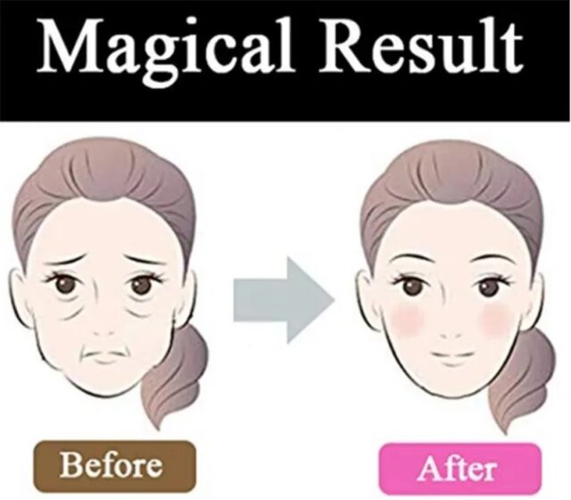 V-Shaped Face Slimming & Chin Lift Shaper Bar - Image 3