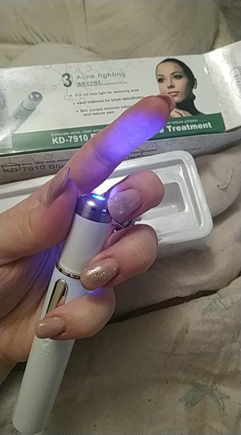 Varicose Veins Pen Relieves Pain & Improves Circulation photo review