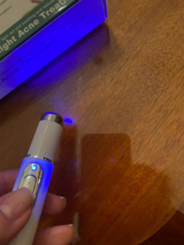 Varicose Veins Pen Relieves Pain & Improves Circulation photo review