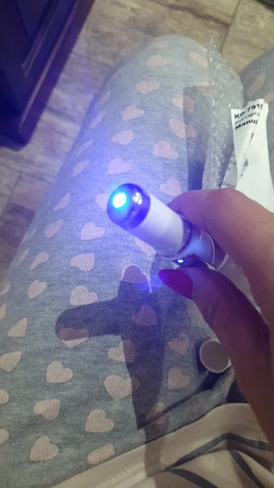 Varicose Veins Pen Relieves Pain & Improves Circulation photo review