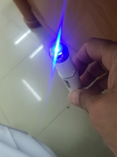 Varicose Veins Pen Relieves Pain & Improves Circulation photo review