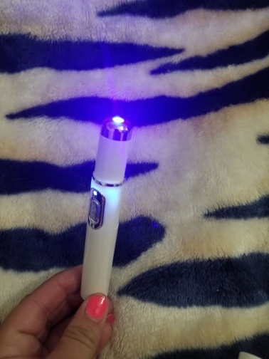 Varicose Veins Pen Relieves Pain & Improves Circulation photo review