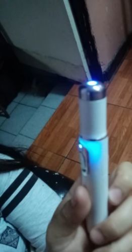 Varicose Veins Pen Relieves Pain & Improves Circulation photo review